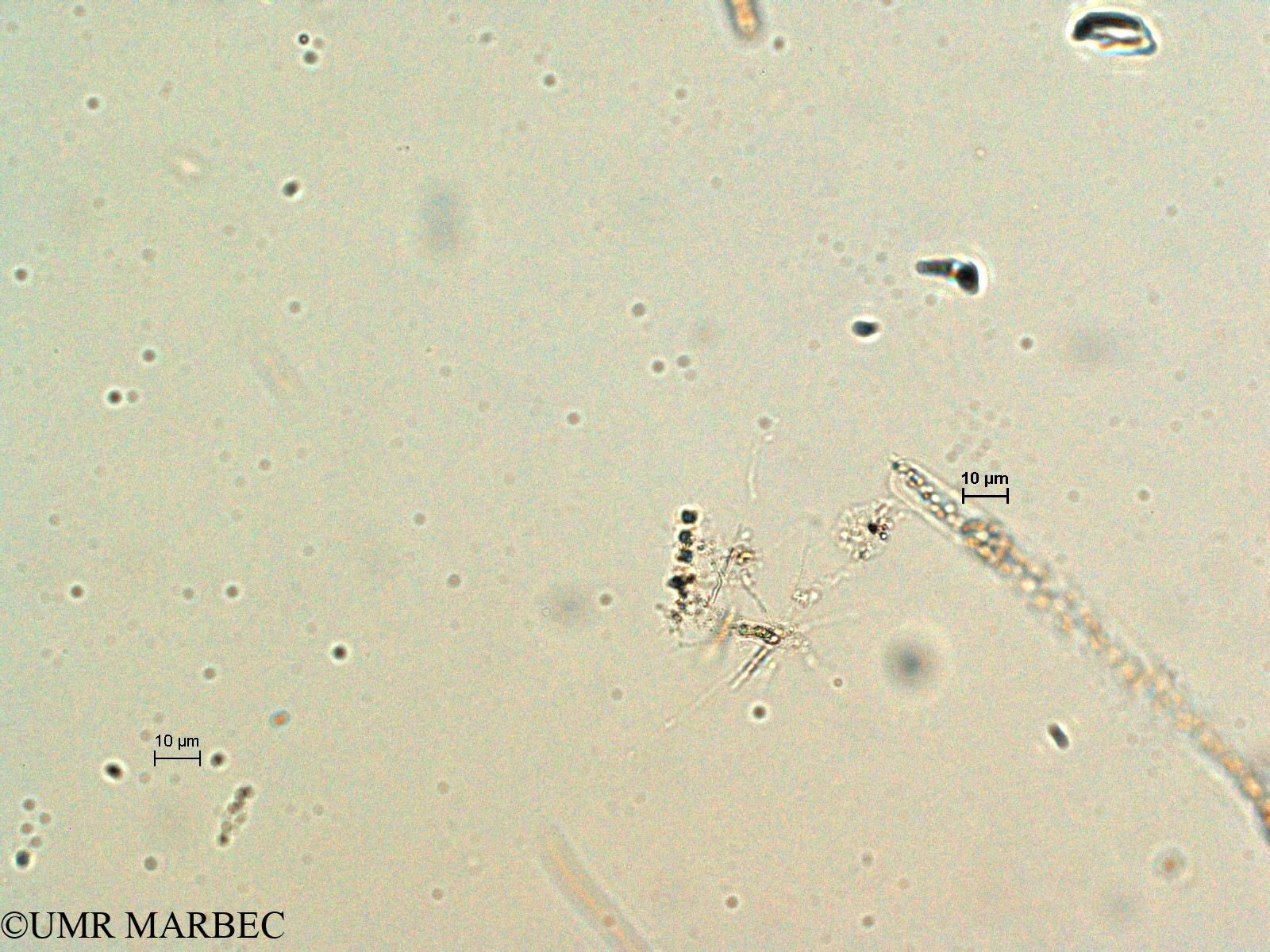 phyto/Scattered_Islands/all/COMMA April 2011/Bacteriastrum sp3 (ancien B. sp8)(copy).jpg